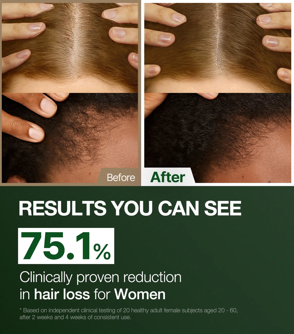 [ROOTON Official Store] Alpha Erguen Shampoo 16.9 Fl.Oz (500Ml) – Women Vegan Formula for anti Hair Loss, Scalp Balancing & Silky Nourishing Care with Clinically Proven Rt-Complex Formula