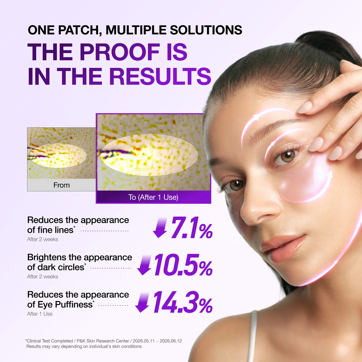 Anua Retinol Berry Revitalizing Eye Patches - 60 Hydrogel Patches for Dark Circles & Fine Lines